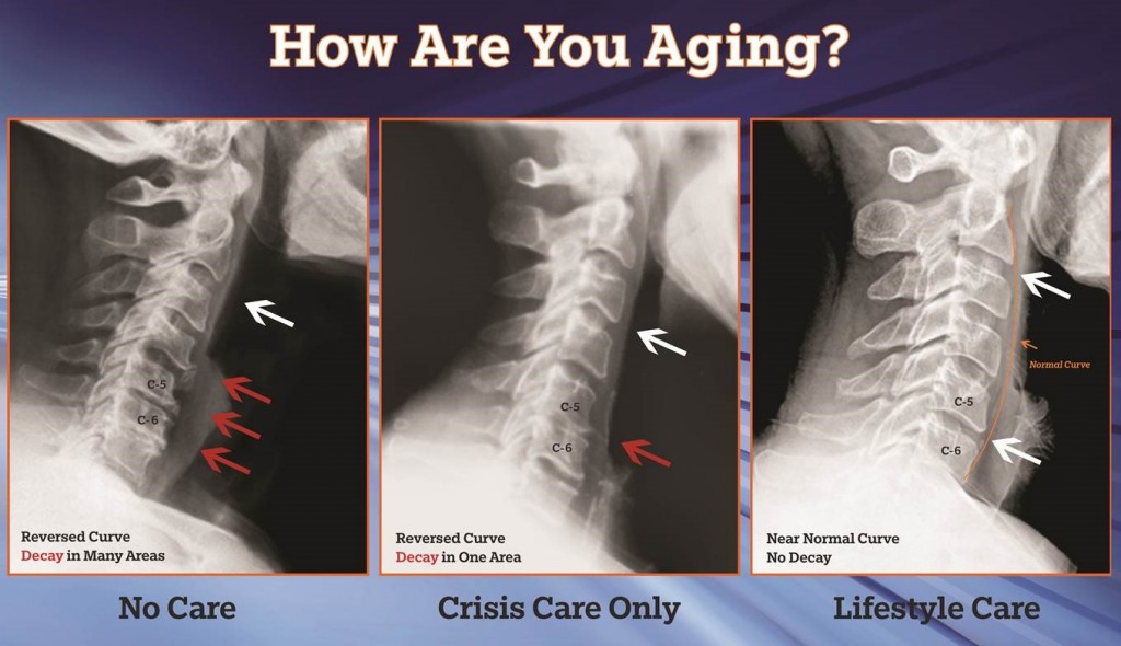 How are you aging Bellevue chiropractor answers
