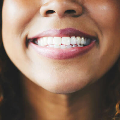 woman smiling with bright white teeth