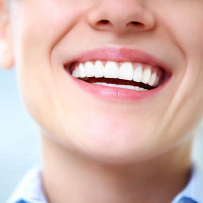 Closeup teeth laughing woman