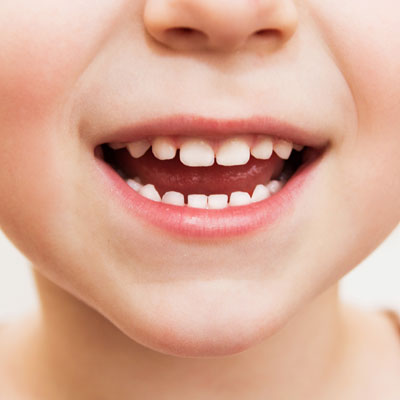 close up of toddler teeth