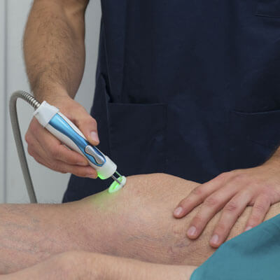 Laser therapy on knee