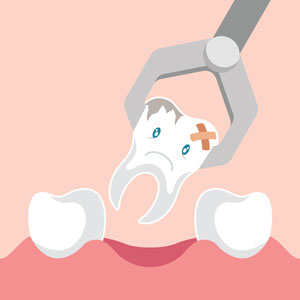 Wisdom Tooth Extraction at Shine Dentists