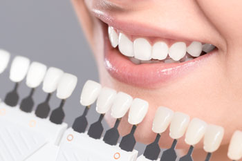 Teeth Whitening Chart